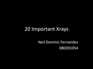 20 Important Xrays

     Neil Dominic Fernandes
                 080201054
 
