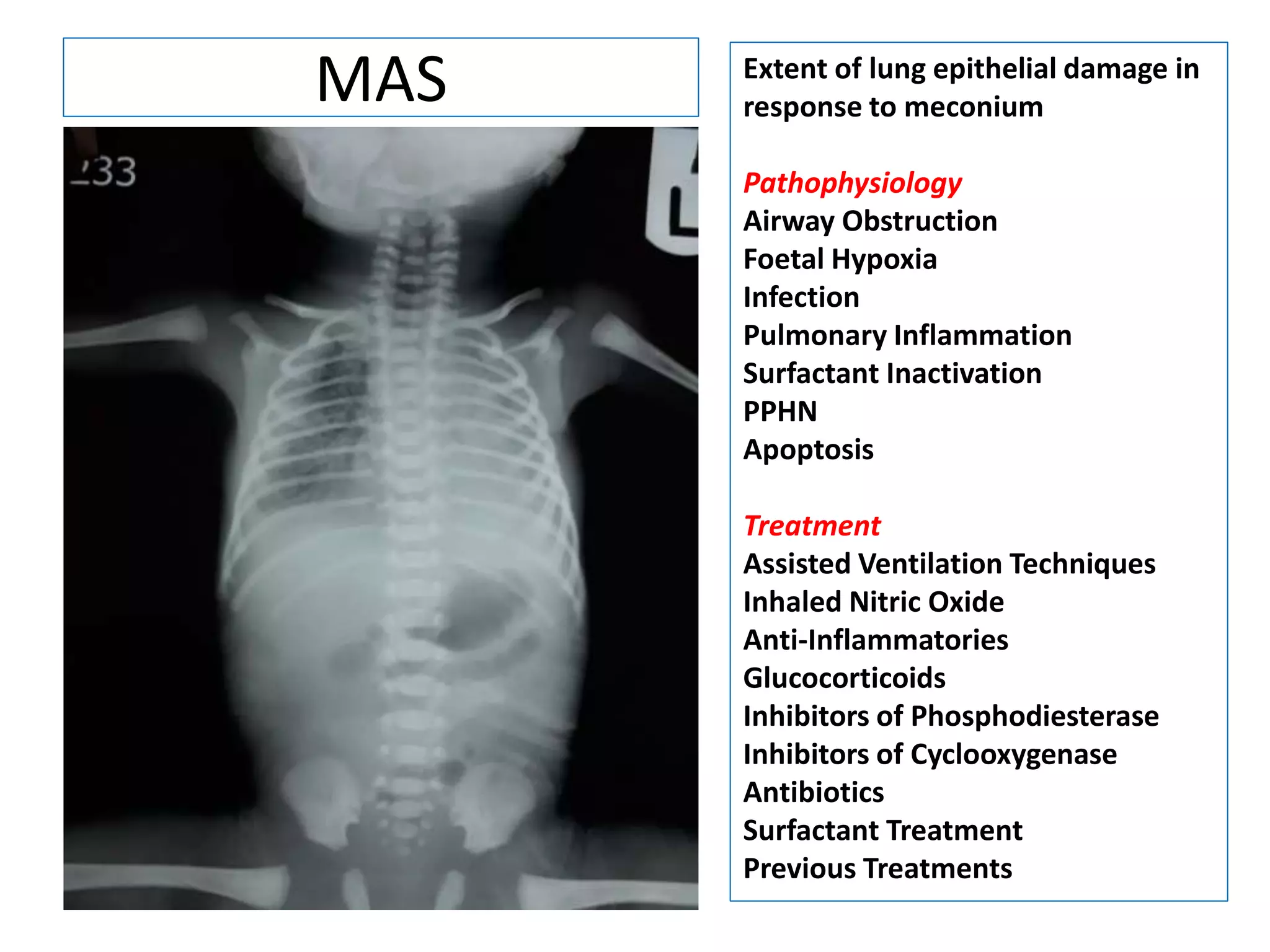 MAS Extent of lung epithelial damage in
response to meconium
Pathophysiology
Airway Obstruction
Foetal Hypoxia
Infection
Pulmonary Inflammation
Surfactant Inactivation
PPHN
Apoptosis
Treatment
Assisted Ventilation Techniques
Inhaled Nitric Oxide
Anti-Inflammatories
Glucocorticoids
Inhibitors of Phosphodiesterase
Inhibitors of Cyclooxygenase
Antibiotics
Surfactant Treatment
Previous Treatments
 