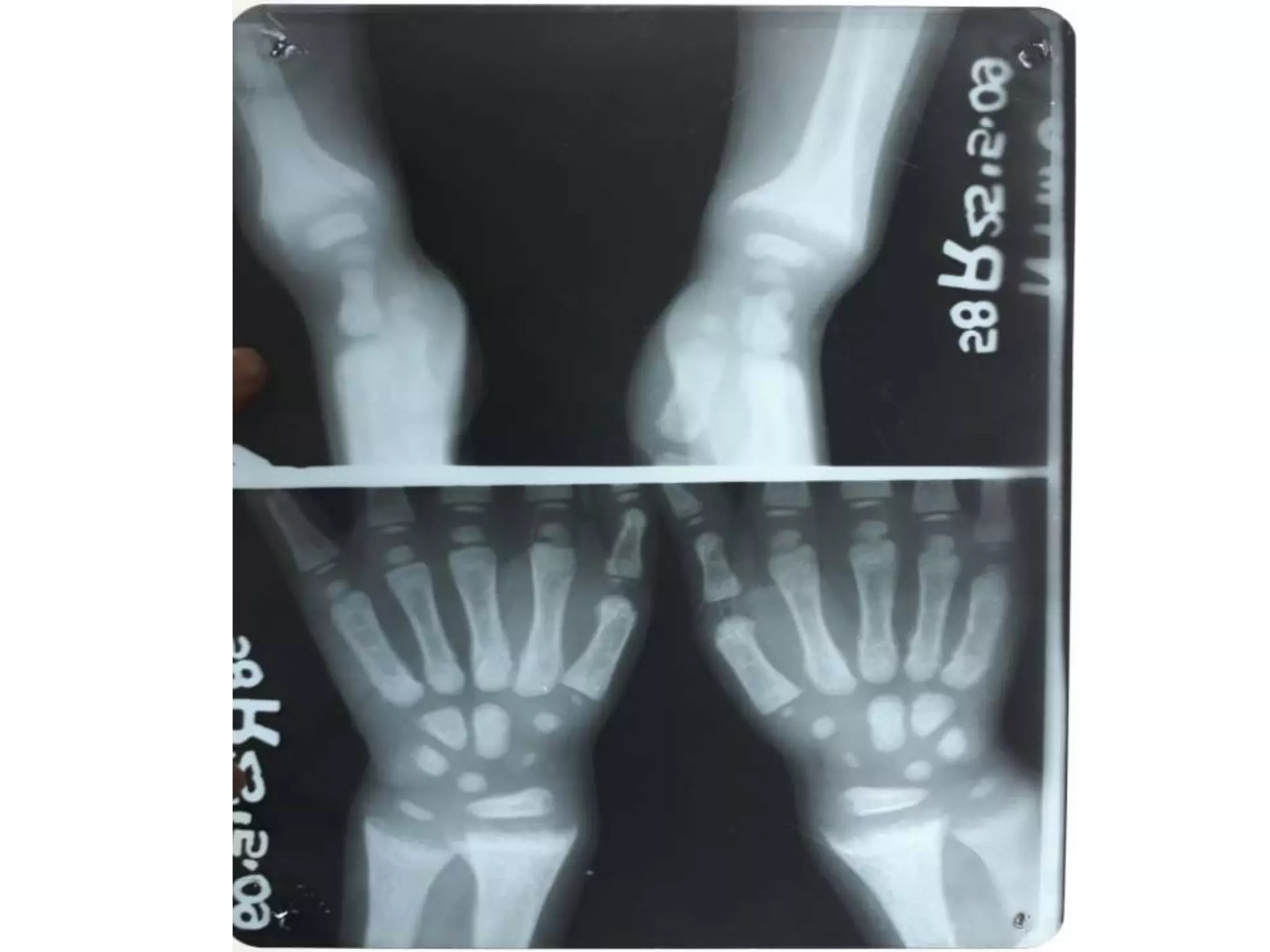 X rays in pediatrics