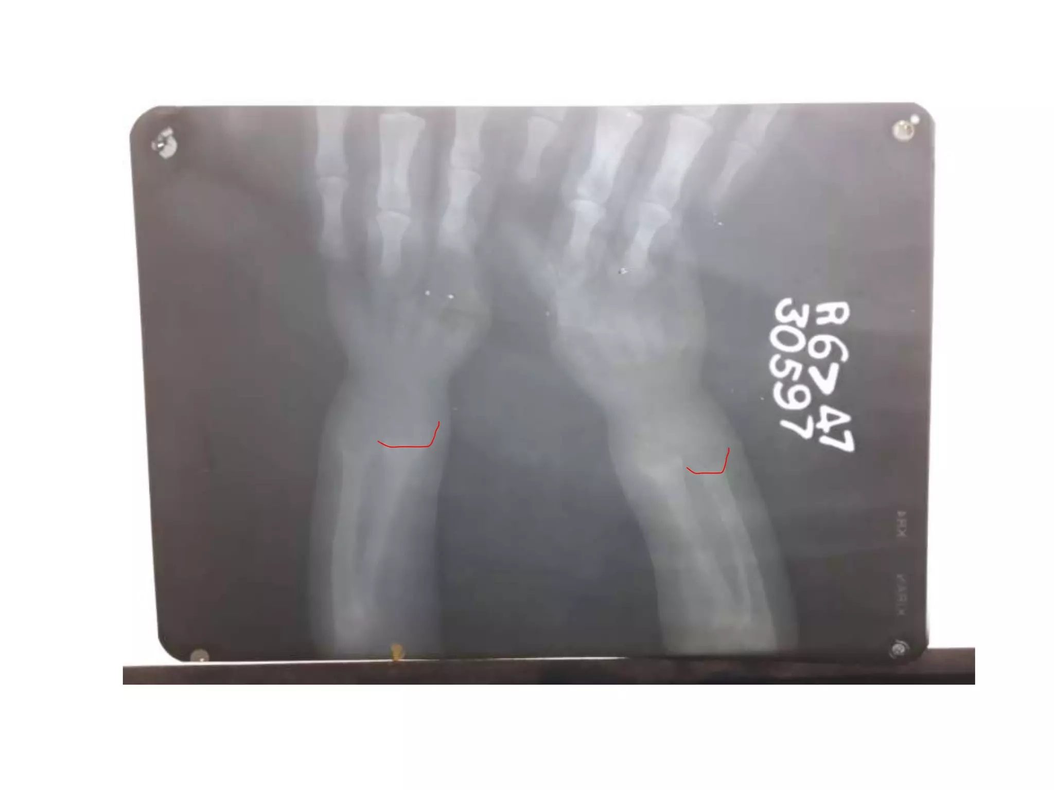 X rays in pediatrics