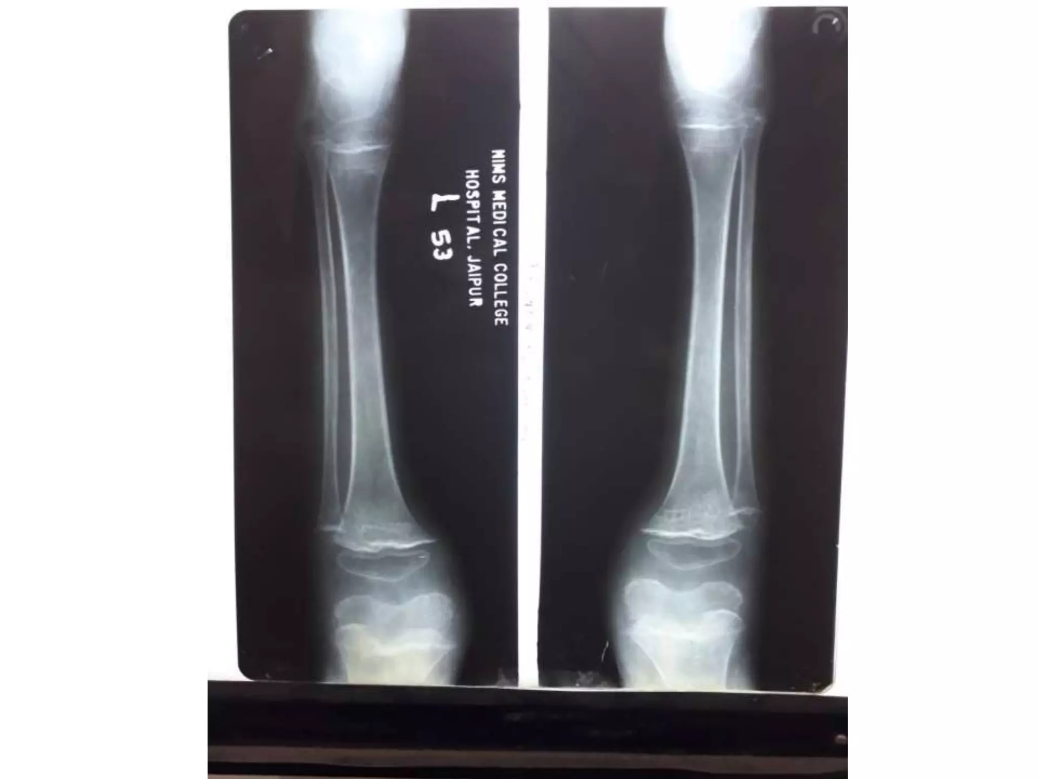 X rays in pediatrics