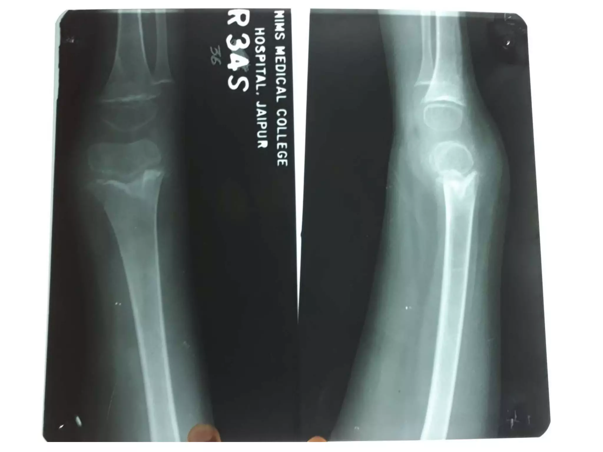 X rays in pediatrics