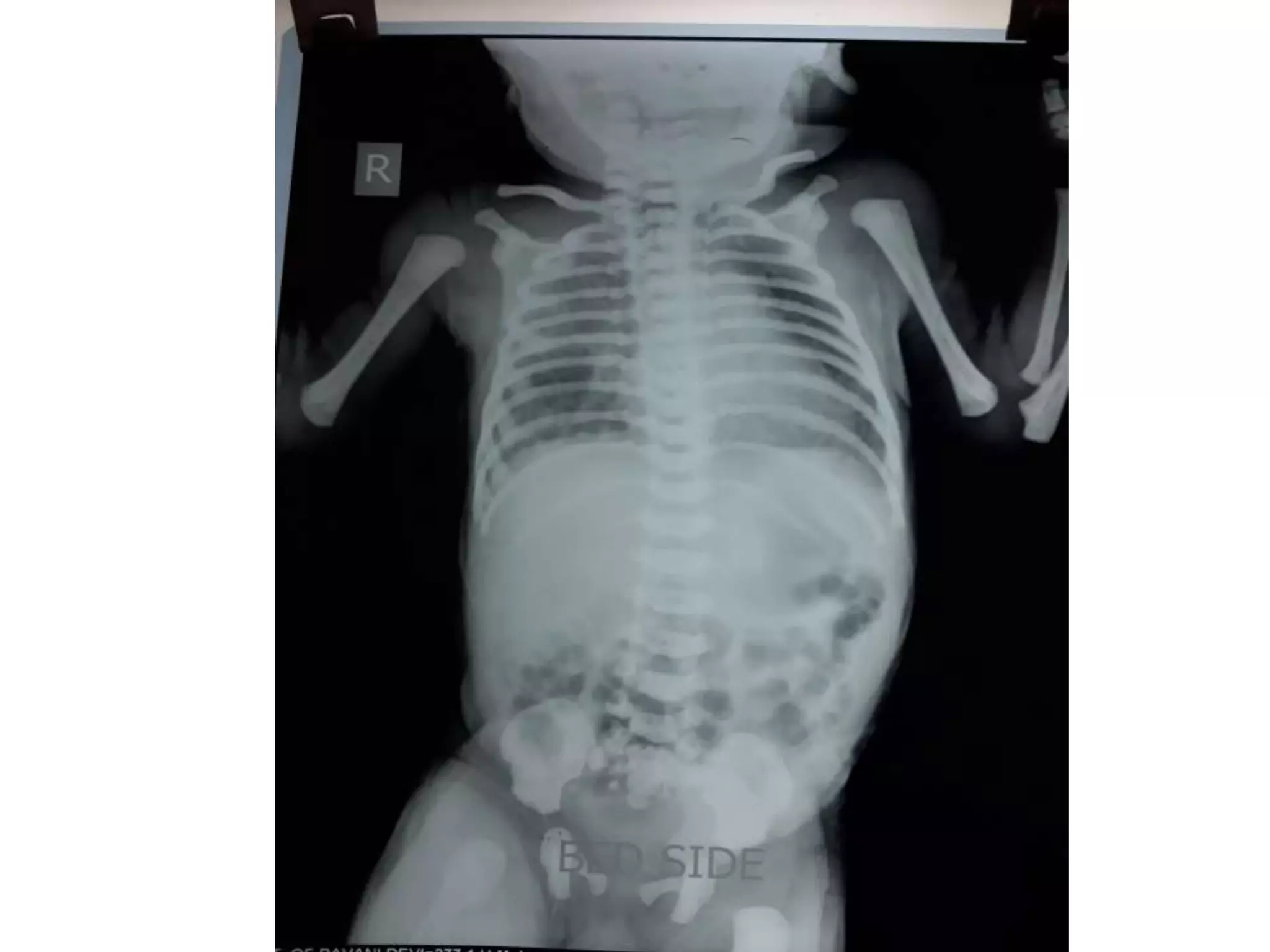 X rays in pediatrics