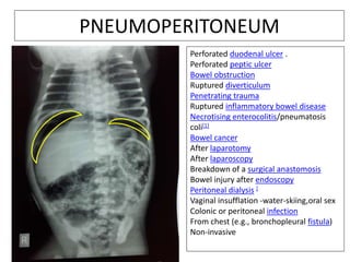 PNEUMOPERITONEUM
Perforated duodenal ulcer .
Perforated peptic ulcer
Bowel obstruction
Ruptured diverticulum
Penetrating trauma
Ruptured inflammatory bowel disease
Necrotising enterocolitis/pneumatosis
coli[1]
Bowel cancer
After laparotomy
After laparoscopy
Breakdown of a surgical anastomosis
Bowel injury after endoscopy
Peritoneal dialysis ]
Vaginal insufflation -water-skiing,oral sex
Colonic or peritoneal infection
From chest (e.g., bronchopleural fistula)
Non-invasive
 