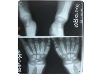 X rays in pediatrics