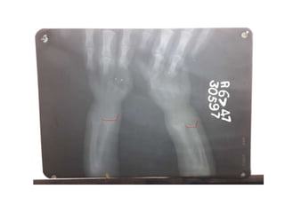 X rays in pediatrics