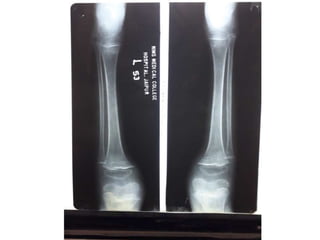 X rays in pediatrics