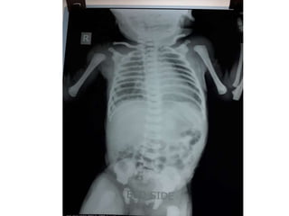 X rays in pediatrics