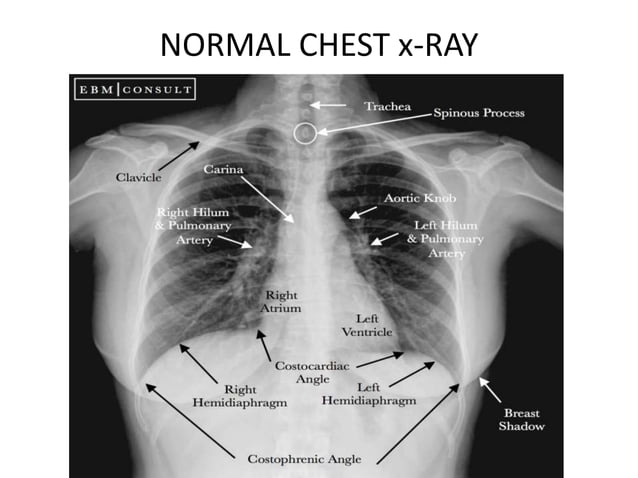 X rays in pediatrics | PPT