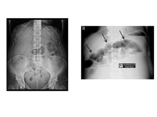 Normal Rug X Ray Xrays | PPTX