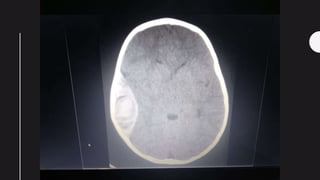 SURGICAL RADIOLOGY | PPTX
