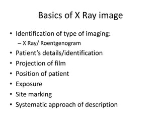 Basics of X Ray image
• Identification of type of imaging:
– X Ray/ Roentgenogram
• Patient’s details/identification
• Projection of film
• Position of patient
• Exposure
• Site marking
• Systematic approach of description
 