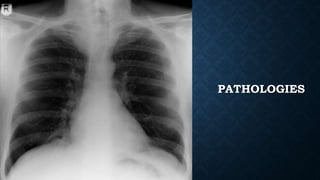 PATHOLOGIES