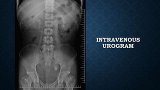 INTRAVENOUS
UROGRAM
 