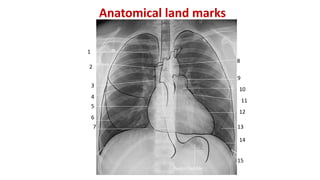 Anatomical land marks
1
3
2
5
4
10
6
7
9
8
11
13
12
14
15
 