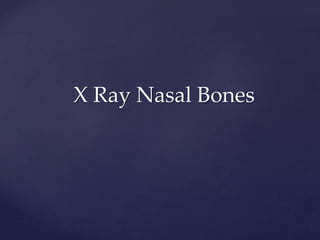 X Ray Nasal Bones
 