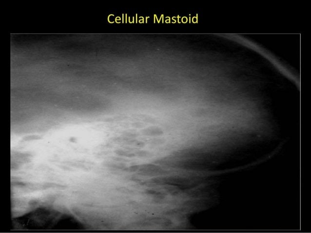 Xrays In Ent Dr Ashly Alexander Xrays In Ent Dr Ashly Alexander
