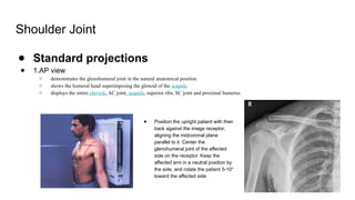 Xrays in Upper and lower limb Joints.pptx