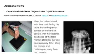 Tangential Hand View Radiography Xrays in Upper and lower limb Joints.pptx