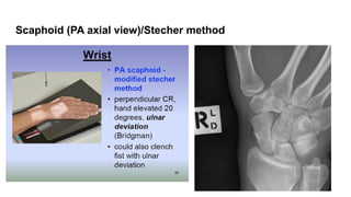 Xrays in Upper and lower limb Joints.pptx