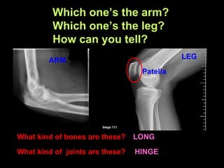 What kind of bones are these? LONG
What kind of joints are these? HINGE
Which one’s the arm?
Which one’s the leg?
How can you tell?
ARM LEG
Patella
 