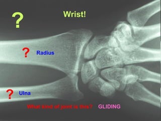?
What kind of joint is this? GLIDING
Wrist!
?
?
Radius
Ulna
 