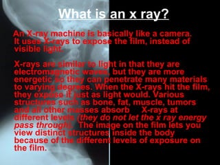 What is an x ray?
An X-ray machine is basically like a camera.
It uses X-rays to expose the film, instead of
visible light.
X-rays are similar to light in that they are
electromagnetic waves, but they are more
energetic so they can penetrate many materials
to varying degrees. When the X-rays hit the film,
they expose it just as light would. Various
structures such as bone, fat, muscle, tumors
and all other masses absorb X-rays at
different levels (they do not let the x ray energy
pass through). The image on the film lets you
view distinct structures inside the body
because of the different levels of exposure on
the film.
 