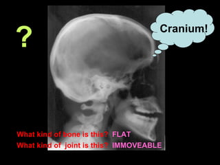 What kind of bone is this? FLAT
What kind of joint is this? IMMOVEABLE
?
Cranium!
 