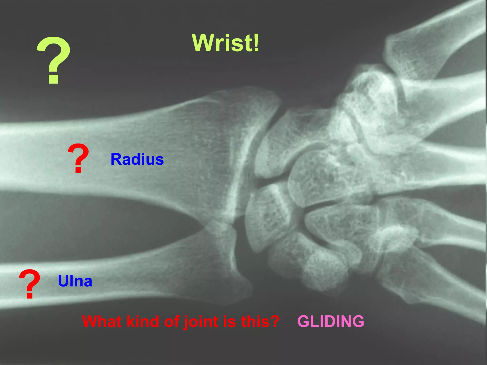 ? What kind of joint is this?  GLIDING Wrist! ? ? Radius Ulna 
