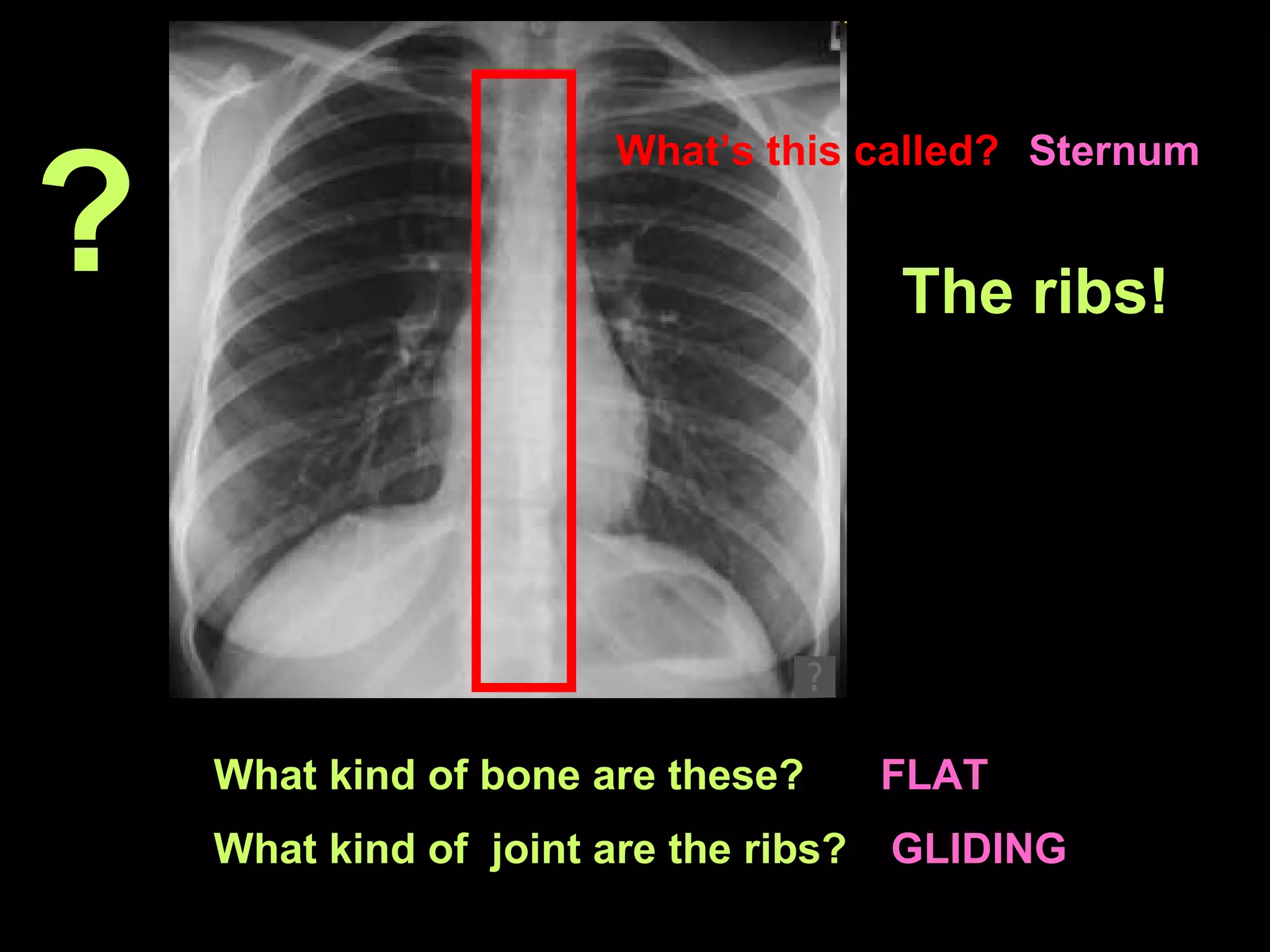 The ribs! What kind of bone are these?  FLAT What kind of  joint are the ribs?  GLIDING What’s this called?   Sternum ? 