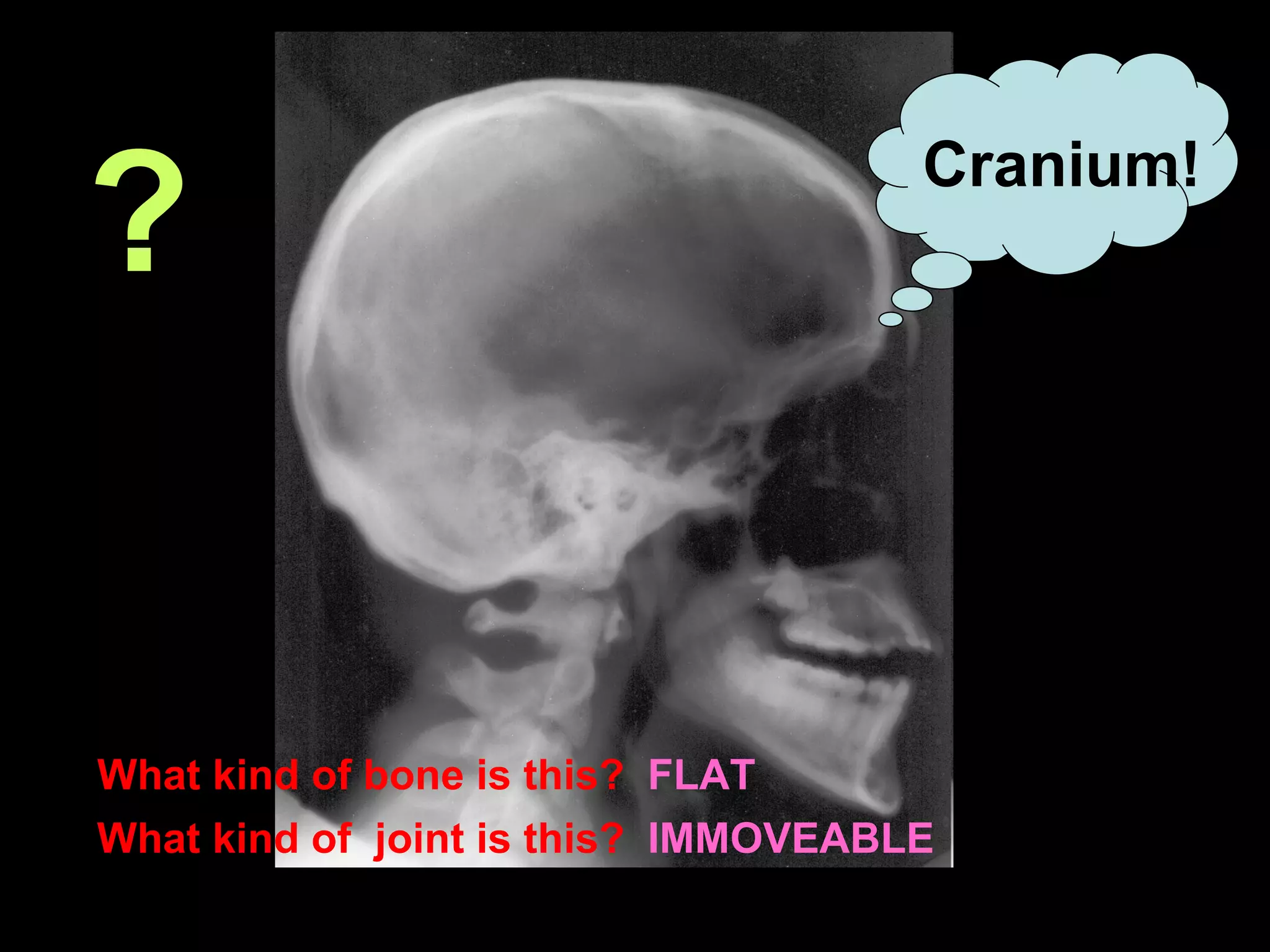 What kind of bone is this?  FLAT What kind of  joint is this?   IMMOVEABLE ? Cranium! 