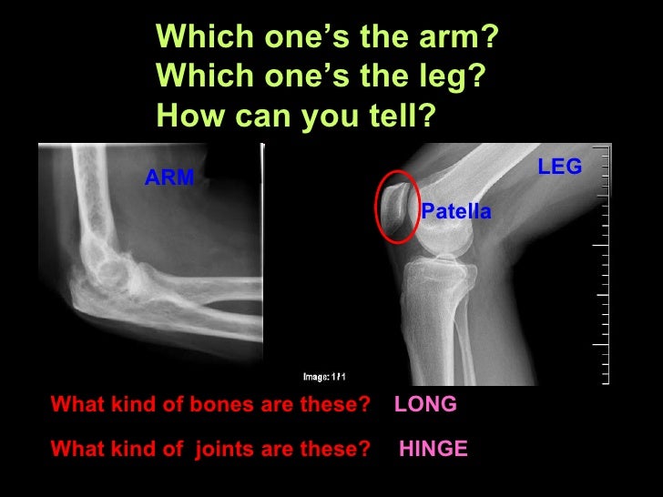 X Rays Ppt