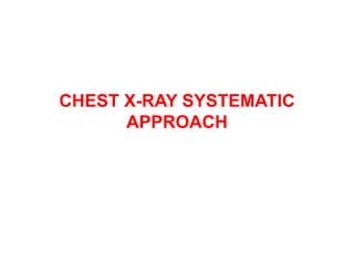 CHEST X-RAY SYSTEMATIC
APPROACH
 