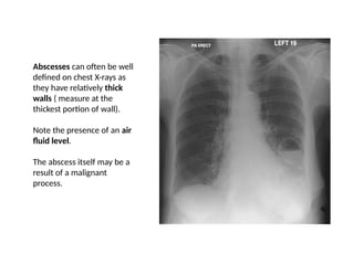 X rays UG class.pptx undergraduate class | PPTX