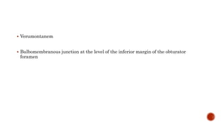  Verumontanem
 Bulbomembranous junction at the level of the inferior margin of the obturator
foramen
 