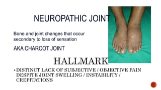 DISTINCT LACK OF SUBJECTIVE / OBJECTIVE PAIN
DESPITE JOINT SWELLING / INSTABILITY /
CREPITATIONS
Bone and joint changes that occur
secondary to loss of sensation
AKA CHARCOT JOINT
NEUROPATHIC JOINT
 