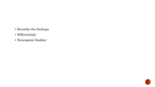  Describe the findings
 Differentials
 Neurogenic bladder
 