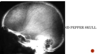 SALT AND PEPPER SKULL
 