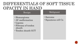 Benign
•Hemangioma
•AV malformation
•Lipoma
•Fibroma of tendon
sheath
•Tendon sheath GCT
Malignant
•Sarcoma
•Squamous cell Ca
 
