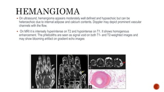  On ultrasound, hemangioma appears moderately well defined and hypoechoic but can be
heteroechoic due to internal adipose and calcium contents. Doppler may depict prominent vascular
channels with the flow.
 On MRI it is intensely hyperintense on T2 and hypointense on T1. It shows homogenous
enhancement. The phleboliths are seen as signal void on both T1- and T2-weighted images and
may show blooming artifact on gradient echo images
 