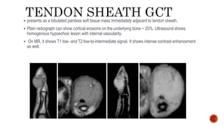 presents as a lobulated painless soft tissue mass immediately adjacent to tendon sheath.
 Plain radiograph can show cortical erosions on the underlying bone ~ 20%. Ultrasound shows
homogenous hypoechoic lesion with internal vascularity.
 On MR, it shows T1 low- and T2 low-to-intermediate signal. It shows intense contrast enhancement
as well.
 