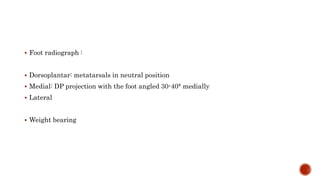  Foot radiograph :
 Dorsoplantar: metatarsals in neutral position
 Medial: DP projection with the foot angled 30-40° medially
 Lateral
 Weight bearing
 