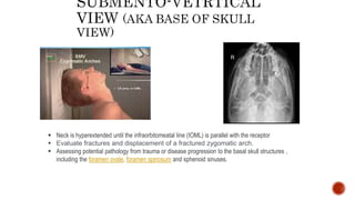  Neck is hyperextended until the infraorbitomeatal line (IOML) is parallel with the receptor
 Evaluate fractures and displacement of a fractured zygomatic arch.
 Assessing potential pathology from trauma or disease progression to the basal skull structures ,
including the foramen ovale, foramen spinosum and sphenoid sinuses.
 