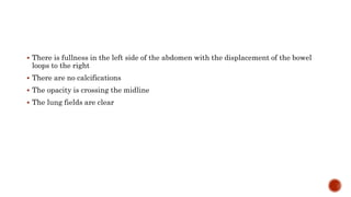  There is fullness in the left side of the abdomen with the displacement of the bowel
loops to the right
 There are no calcifications
 The opacity is crossing the midline
 The lung fields are clear
 