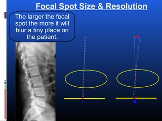 Focal Spot Size & Resolution
The larger the focal
spot the more it will
blur a tiny place on
the patient.
 