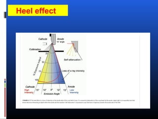 Heel effect
 