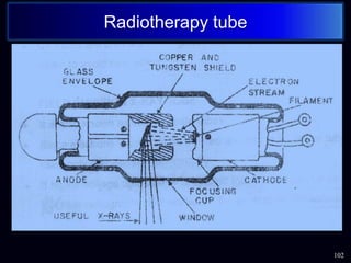 102
Radiotherapy tube
 