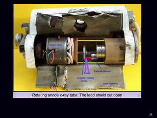 Rotating anode x-ray tube: The lead shield cut open
58
 