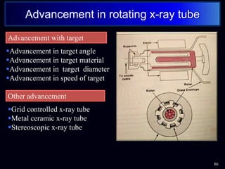 86
Advancement in rotating x-ray tube
Advancement in target angle
Advancement in target material
Advancement in target diameter
Advancement in speed of target

Advancement with target
Grid controlled x-ray tube
Metal ceramic x-ray tube
Stereoscopic x-ray tube
Other advancement
 