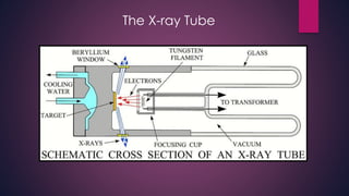 The X-ray Tube
 